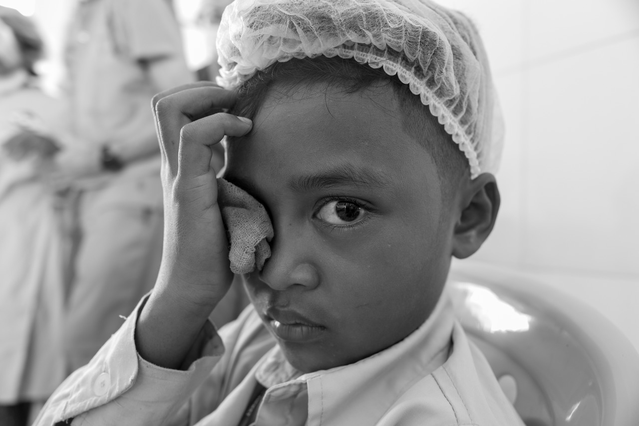 eye treatment