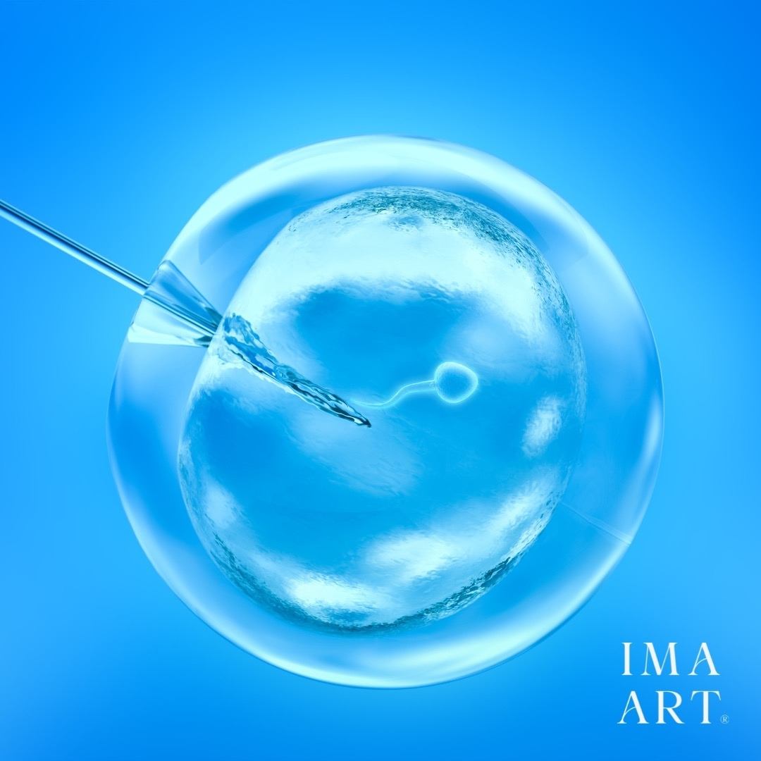 ICSI procedure showing sperm injected into human egg with microscopic needle